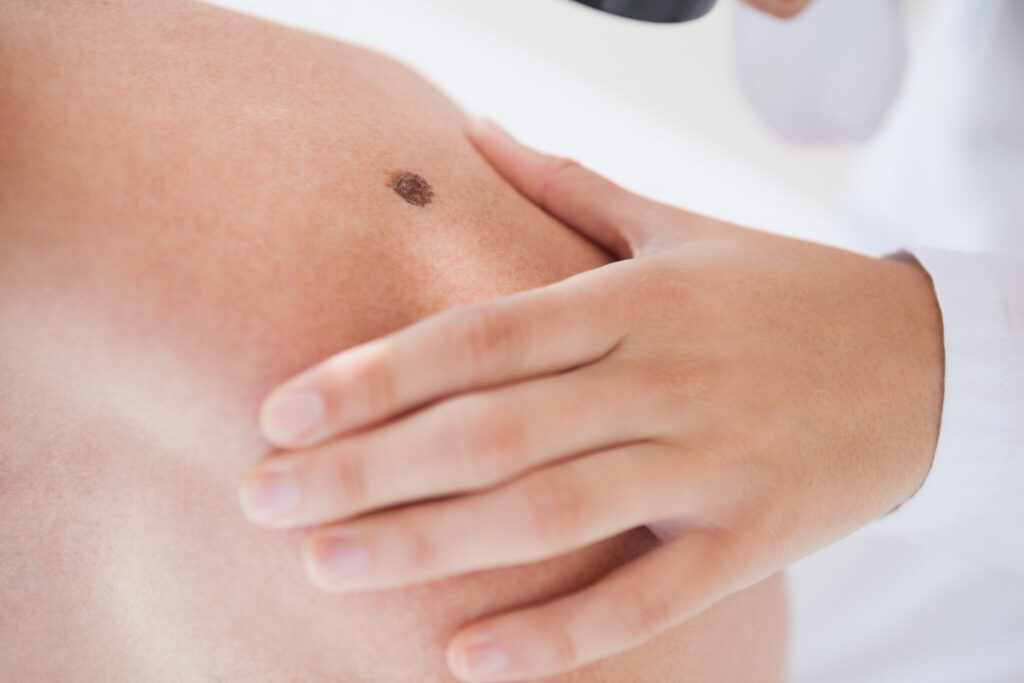 Hautveränderungen - weinberger aesthetics